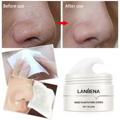 Blackhead Remover Nose Mask – Deep Cleansing Pore Care Cream