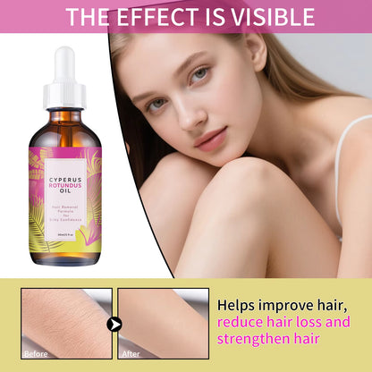 Hair Minimizing Body Oil – Jojoba & Almond Skin Softening Oil (60mL)