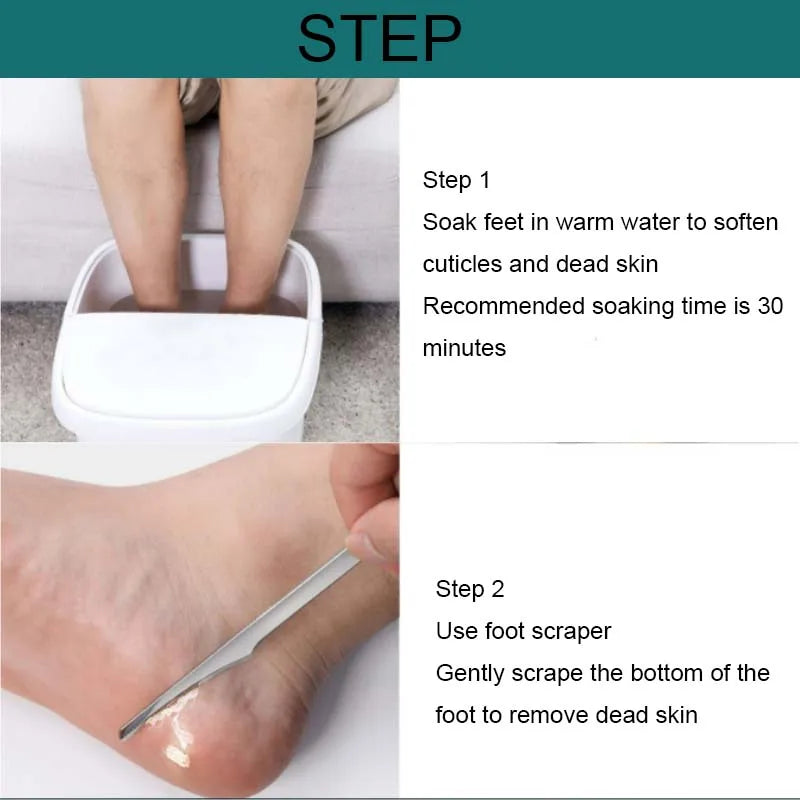 1Pcs Manicure Pedicure Tools Toe Nail Shaver Feet Pedicure Knife Kit Foot Callus Rasp File Dead Skin Remover Foot Care Tools