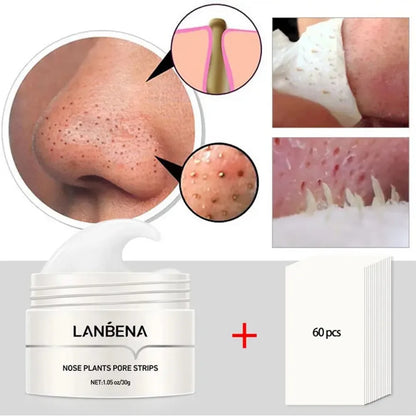 Blackhead Remover Nose Mask – Deep Cleansing Pore Care Cream