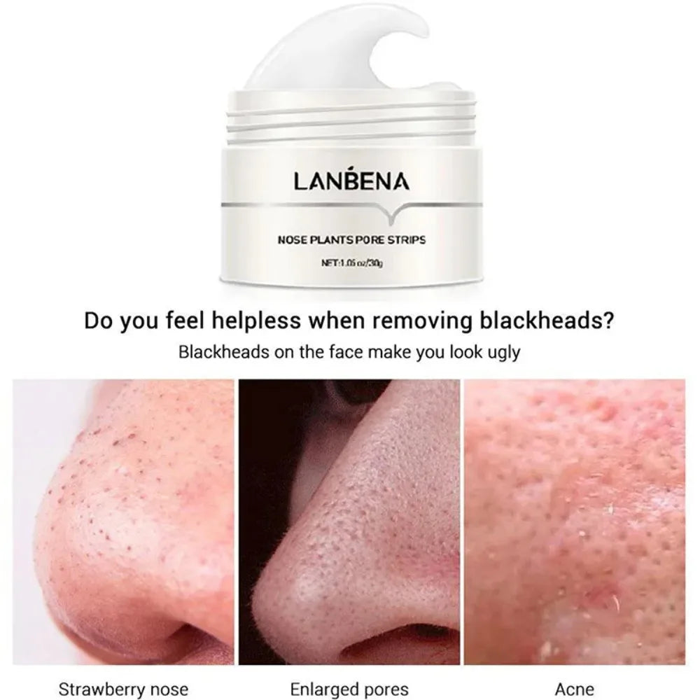 Blackhead Remover Nose Mask – Deep Cleansing Pore Care Cream